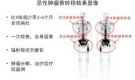 上饒市信州區惠民醫院核醫學(xué)科骨檢查與治療